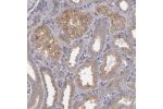 Immunohistochemical staining of human kidney shows moderate granular cytoplasmic positivity in cells in tubules.