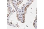 Immunohistochemical staining of human gall bladder shows nuclear positivity in glandular cells.
