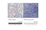 Immunohistochemistry analysis in human kidney and lymph node tissues using HPA002083 antibody. Corresponding HNF1B RNA-seq data are presented for the same tissues.