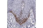 Immunohistochemical staining of human oral mucosa shows moderate nuclear positivity in subset of squamous epithelial cells.