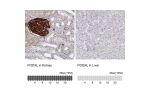 Immunohistochemistry analysis in human kidney and liver tissues using HPA002110 antibody. Corresponding PODXL RNA-seq data are presented for the same tissues.