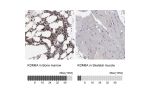 Immunohistochemistry analysis in human bone marrow and skeletal muscle tissues using HPA002111 antibody. Corresponding KDM6A RNA-seq data are presented for the same tissues.