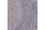Immunohistochemical staining of human lymph node shows cytoplasmic positivity in subse of germinal center and non-germinal center cells.