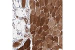 Immunohistochemical staining of human skeletal muscle shows strong cytoplasmic positivity in myocytes.