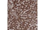 Immunohistochemical staining of human liver shows strong cytoplasmic positivity in hepatocytes.