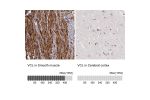 Immunohistochemistry analysis in human smooth muscle and cerebral cortex tissues using HPA002131 antibody. Corresponding VCL RNA-seq data are presented for the same tissues.