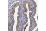 Immunohistochemical staining of human fallopian tube shows weak cytoplasmic/membranous positivity in glandular cells.