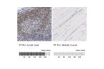 Immunohistochemistry analysis in human lymph node and skeletal muscle tissues using HPA002134 antibody. Corresponding IFI16 RNA-seq data are presented for the same tissues.
