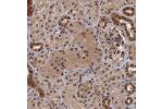 Immunohistochemical staining of human colon shows strong nuclear and cytoplasmic positivity in glandular cells.