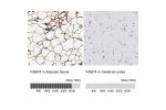 Immunohistochemistry analysis in human adipose tissue and cerebral cortex tissues using HPA002188 antibody. Corresponding FABP4 RNA-seq data are presented for the same tissues.