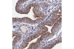 Immunohistochemical staining of human fallopian tube shows granular cytoplasmic positivity in glandular cells.