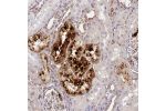 Immunohistochemical staining of human kidney shows strong cytoplasmic positivity in cells in tubules.