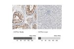 Immunohistochemistry analysis in human testis and liver tissues using Anti-CCT5 antibody. Corresponding CCT5 RNA-seq data are presented for the same tissues.