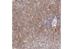Immunohistochemical staining of human liver shows moderate cytoplasmic positivity in hepatocytes.