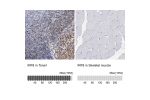 Immunohistochemistry analysis in human tonsil and skeletal muscle tissues using HPA002267 antibody. Corresponding IRF8 RNA-seq data are presented for the same tissues.