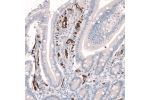 Immunohistochemical staining of human duodenum shows strong membranous positivity in endothelial cells.