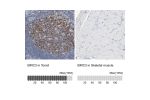 Immunohistochemistry analysis in human tonsil and skeletal muscle tissues using HPA002317 antibody. Corresponding BIRC3 RNA-seq data are presented for the same tissues.