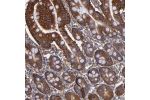 Immunohistochemical staining of human small intestine shows strong cytoplasmic positivity in glandular cells.