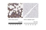 Immunohistochemistry analysis in human bone marrow and skeletal muscle tissues using Anti-NCF2 antibody. Corresponding NCF2 RNA-seq data are presented for the same tissues.