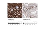 Immunohistochemistry analysis in human liver and testis tissues using HPA002328 antibody. Corresponding MAOB RNA-seq data are presented for the same tissues.