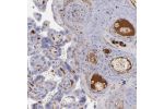 Immunohistochemical staining of human placenta shows strong positivity in plasma.