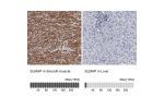 Immunohistochemistry analysis in human smooth muscle and liver tissues using Anti-SLMAP antibody. Corresponding SLMAP RNA-seq data are presented for the same tissues.