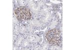 Immunohistochemical staining of human kidney shows strong cytoplasmic positivity in a subset of cells in glomeruli.