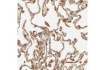 Immunohistochemical staining of human lung shows cytoplasmic and membranous positivity in pneumocytes.