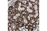 Immunohistochemical staining of human kidney shows strong cytoplasmic positivity in cells of tubules.