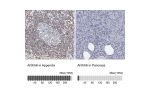 Immunohistochemistry analysis in human appendix and pancreas tissues using Anti-ANXA6 antibody. Corresponding ANXA6 RNA-seq data are presented for the same tissues.