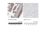 Immunohistochemistry analysis in human prostate and liver tissues using HPA002476 antibody. Corresponding ABCC4 RNA-seq data are presented for the same tissues.