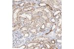 Immunohistochemical staining of human kidney shows moderate granular positivity in renal tubules.