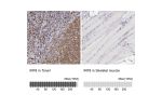 Immunohistochemistry analysis in human tonsil and skeletal muscle tissues using HPA002531 antibody. Corresponding IRF8 RNA-seq data are presented for the same tissues.