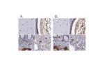 Immunohistochemical staining of human cerebral cortex, cervix, uterine, colon and liver using Anti-SERPINA3 antibody HPA002560 (A) shows similar protein distribution across tissues to independent antibody HPA000893 (B).