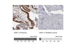 Immunohistochemistry analysis in human placenta and skeletal muscle tissues using HPA002632 antibody. Corresponding SND1 RNA-seq data are presented for the same tissues.