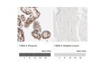 Immunohistochemistry analysis in human placenta and skeletal muscle tissues using HPA002637 antibody. Corresponding CDK6 RNA-seq data are presented for the same tissues.