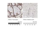 Immunohistochemistry analysis in human thyroid gland and skeletal muscle tissues using HPA002645 antibody. Corresponding PDIA3 RNA-seq data are presented for the same tissues.