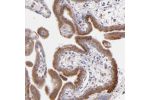 Immunohistochemical staining of human placenta shows moderate granular cytoplasmic positivity in trophoblastic cells.