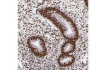 Immunohistochemical staining of human endometrium shows strong nuclear positivity in glandular cells.