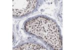 Immunohistochemical staining of human testis shows strong nuclear positivity in cells of seminiferus ducts.