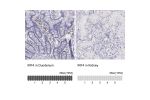 Immunohistochemistry analysis in human duodenum and kidney tissues using HPA002698 antibody. Corresponding IRF4 RNA-seq data are presented for the same tissues.