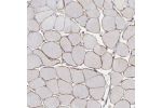 Immunohistochemical staining of human skeletal muscle shows moderate membranous positivity in myocytes.