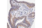 Immunohistochemical staining of human Fallopian tube shows moderate cytoplasmic positivity in glandular cells.