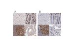 Immunohistochemical staining of human cerebral cortex, colon, lymph node and testis using Anti-TERF2 antibody HPA002735 (A) shows similar protein distribution across tissues to independent antibody HPA001907 (B).