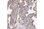 Immunohistochemical staining of human placenta shows moderate extracellular space positivity in trophoblastic cells.