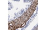 Immunohistochemical staining of human prostate shows strong membranous positivity in smooth muscle cells.