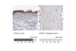 Immunohistochemistry analysis in human skin and skeletal muscle tissues using Anti-PTGS1 antibody. Corresponding PTGS1 RNA-seq data are presented for the same tissues.