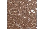 Immunohistochemical staining of human liver shows strong cytoplasmic positivity in hepatocytes.
