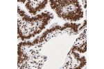 Immunohistochemical staining of human fallopian tube shows strong nuclear positivity in glandular cells.