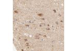 Immunohistochemical staining of human cerebral cortex shows strong cytoplasmic positivity in granular pattern in neuronal cells.